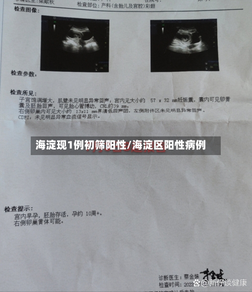 海淀现1例初筛阳性/海淀区阳性病例-第2张图片